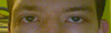 This is my with my eyes in a relaxed position.