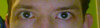 For comparison, this is my habit of holding my eyes extra-open to try to compensate for the droopiness/asymmetry.