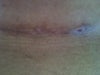 small wound w/ nothing on it.