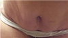 What I am most concerned about,this is just slightly bending over.  This is what I was told I could do a mini for
