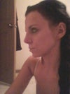 This is my nose after 5 weeks. my radix looks horrible. my nose is still large :( Im depressed!