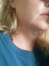 Circled area where hard lump is that hurts