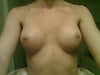 Post surgery