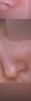 1. Original nose.
2. Altered nose.
3. Original nose.
4. Altered nose.

I would like to know if there are any ways to get my nose looking like the altered images or if it's even possible.
Initial thoughts would be great.