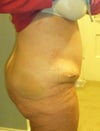 Here you can see the rather large bulge/roll on the left side.