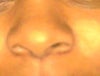 really dislike my nose.