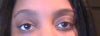 one eye is noticeably bigger
