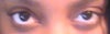 would like for my eyes to be the same size UGH!