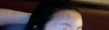 too much fat injected