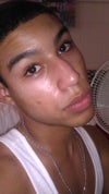 This is what I am most insecure about. My nose seems to protrude to the left more and the right side is flat. From far away it makes my nose appear bigger