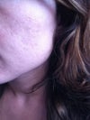 My left cheek