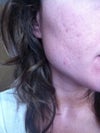 My right cheek