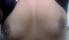 pre-op