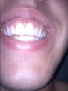 smile
