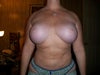 5 months PO, "bottom out" ?