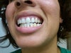 See top and bottom gaps.