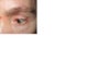 this is my eyelid that I wish to raise via the brow