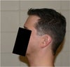 View of the Left arm side of my head
(Hair not highlighted in these)