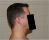View of the Right arm side of my head
(Hair not highlighted in these)