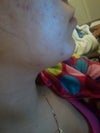 this is how my skin looks now, when just 3 months ago I had flawless skin