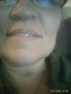 around mouth