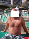 belly looks deformed
and hair is gone sideways,
before it used to cover my belly bottom