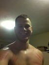 Sagging Chin