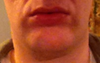 jowls under corners of mough