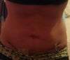 See the loose skin?