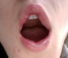 Very lumpy