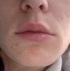 The top lip is uneven, and the right side seems less filled than the left side.