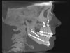 right ct scan