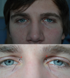 black arrows - hollowness; red stars - possible injection points