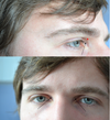 black arrows - hollowness; red stars - possible injection points