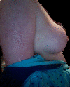 Side view post augmentation and lift