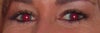 Before ever getting botox