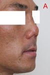 Current shape 3/4 view