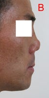 Current shape profile