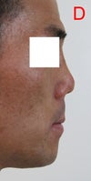 Photoshopped version showing desired result