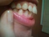 after.
