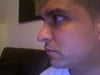 right side