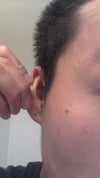 Right ear