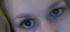 Eye droop