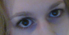 Eye droop 2
