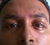 After around 4 weeks of surgery