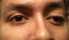 Present scenario almost 5 months after surgery
