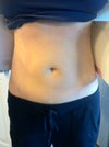 post op 12 hours