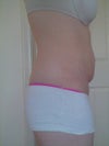 Almost 6 months post pregnancy