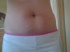 Almost 6 months post pregnancy