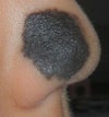 nose part